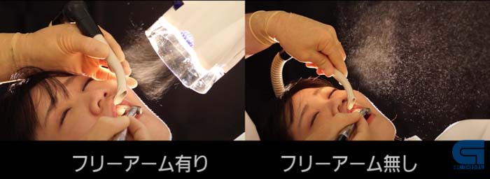口腔外バキューム